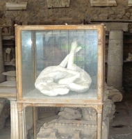 Body casts